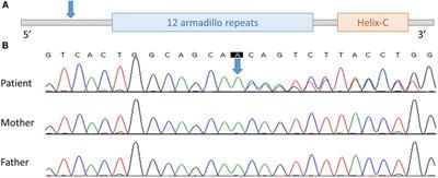 CTNNB1-related neurodevelopmental disorder mimics cerebral palsy: case report